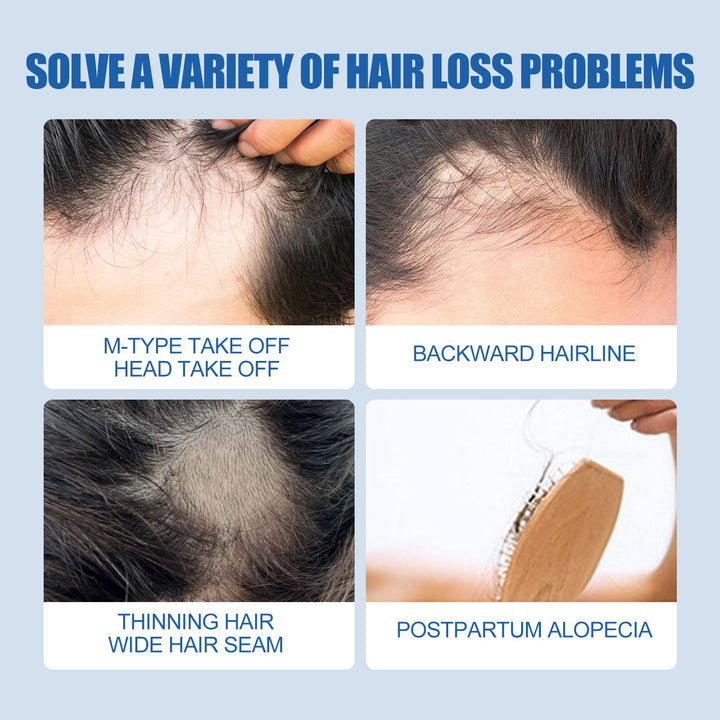 Men's Hair & Beard Nourishing Serum | Scalp & Beard Care